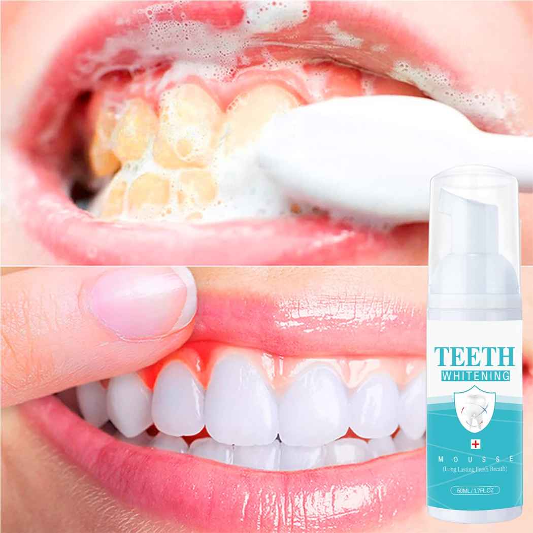 Teeth Whitener Foam